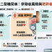 瘦子也會得糖尿病？併發症風險大不同！